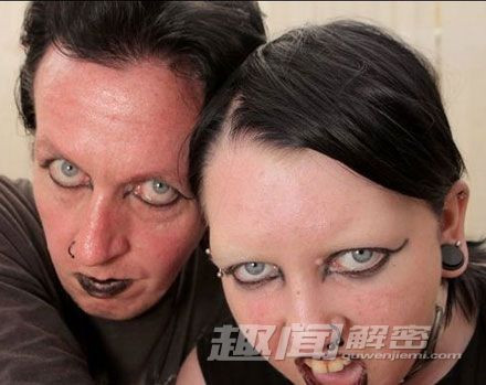 10 căn bệnh đáng sợ trong lịch sử loài người - Ảnh 1 10 căn bệnh đáng sợ trong lịch sử loài người - Ảnh 1