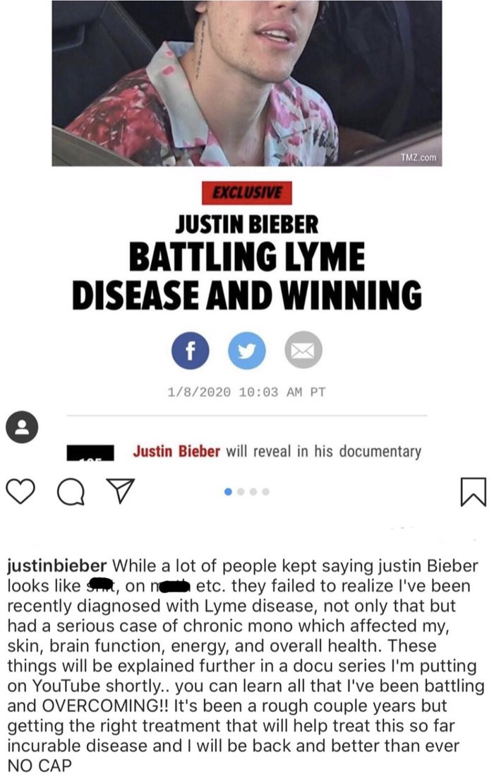  Giữa vụ lùm xùm về việc tranh ngôi vị nhất bảng, Justin Bieber đã lên tiếng về căn bệnh Lyme đã dày vò bản thân mình hơn 1 năm qua và điều đó đã giúp phá vỡ bầu không khí căng thẳng từ sự kiện đầy thị phi trước đó.