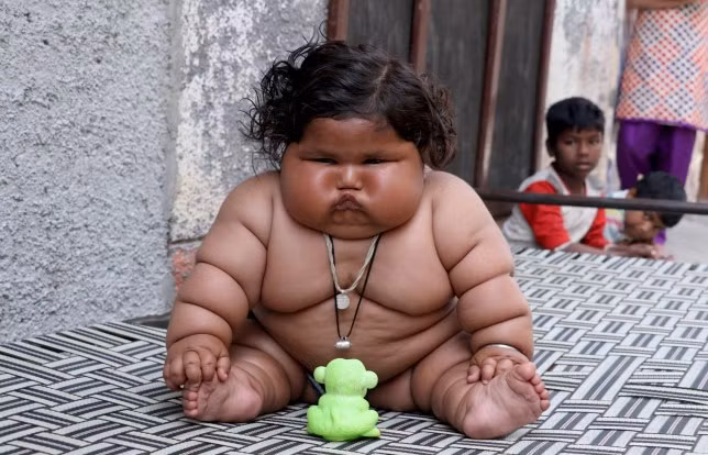 Cuộc sống của bé gái Ấn Độ 8 tháng tuổi nặng gần 20kg giờ ra sao?