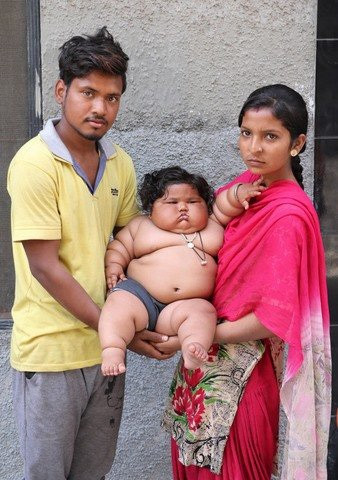 8 tháng tuổi đã gần 20kg, cuộc sống của bé gái nặng ký nhất Ấn Độ hiện tại như thế nào sau 3 năm phát triển với tốc độ chóng mặt?-3