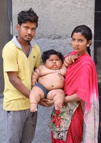 8 tháng tuổi đã gần 20kg, cuộc sống của bé gái nặng ký nhất Ấn Độ hiện tại như thế nào sau 3 năm phát triển với tốc độ chóng mặt?-3