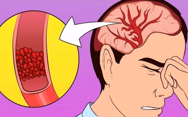 Bị nhức đầu, uể oải hay mất ngủ là dấu hiệu cơ thể bạn đang thiếu trầm trọng 2 vi chất sau