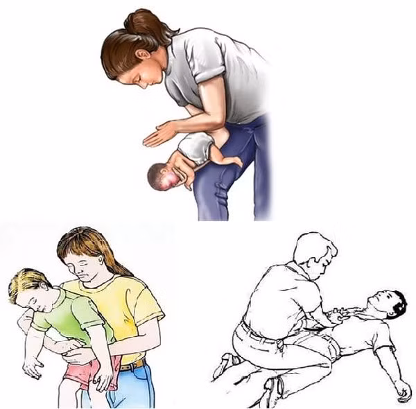 Kỹ năng sơ cấp cứu 2