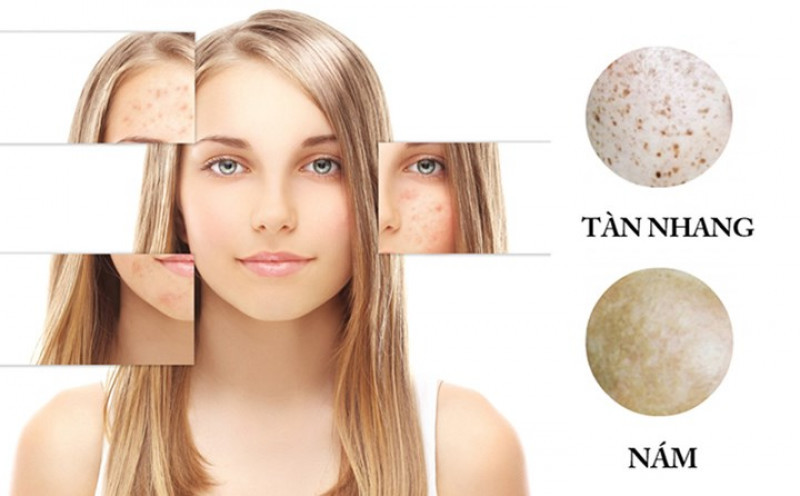 Trị nám, tàn nhang: Thành phần của vỏ bưởi chứa lycopene nên vỏ bưởi còn ngăn ngừa ung thư do tia cực tím gây nên. Vì thế vỏ bưởi có tác dụng ngăn ngừa lão hóa, giảm các nếp nhăn, nám, tàn nhang trên mặt. Trị nám, tàn nhang: Thành phần của vỏ bưởi chứa lycopene nên vỏ bưởi còn ngăn ngừa ung thư do tia cực tím gây nên. Vì thế vỏ bưởi có tác dụng ngăn ngừa lão hóa, giảm các nếp nhăn, nám, tàn nhang trên mặt.