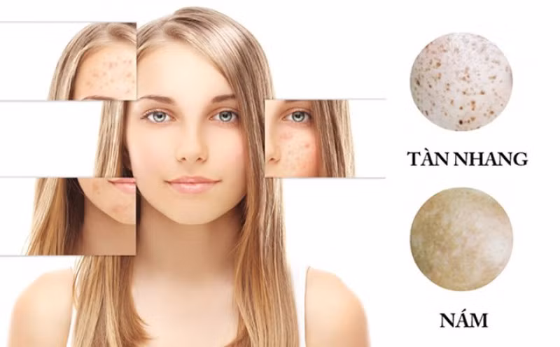 Trị nám, tàn nhang: Thành phần của vỏ bưởi chứa lycopene nên vỏ bưởi còn ngăn ngừa ung thư do tia cực tím gây nên. Vì thế vỏ bưởi có tác dụng ngăn ngừa lão hóa, giảm các nếp nhăn, nám, tàn nhang trên mặt.