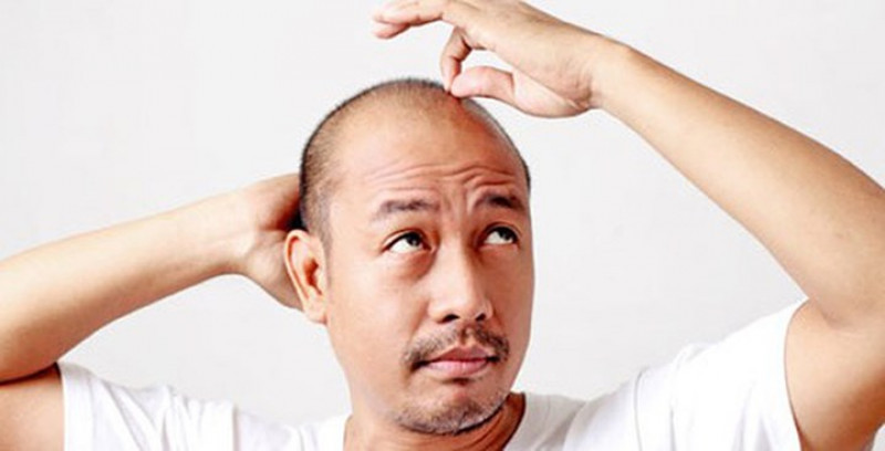 Trị hói đầu: Nếu bạn còn trẻ mà đã có dấu hiệu bị hói thì hãy dùng vỏ bưởi tươi xịt lên tóc, tinh dầu trong vỏ bưởi có tác dụng kích thích tóc mọc ra. Nếu thể trạng bạn phù hợp thì sẽ có cảm giác tóc dày lên rõ sau một thời gian. Mẹo này có thể giúp trị rụng tóc và thưa tóc, tránh bị hói. Trị hói đầu: Nếu bạn còn trẻ mà đã có dấu hiệu bị hói thì hãy dùng vỏ bưởi tươi xịt lên tóc, tinh dầu trong vỏ bưởi có tác dụng kích thích tóc mọc ra. Nếu thể trạng bạn phù hợp thì sẽ có cảm giác tóc dày lên rõ sau một thời gian. Mẹo này có thể giúp trị rụng tóc và thưa tóc, tránh bị hói.