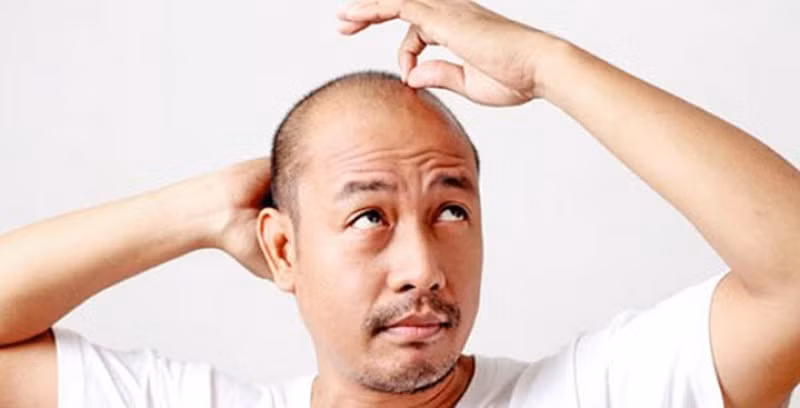 Trị hói đầu: Nếu bạn còn trẻ mà đã có dấu hiệu bị hói thì hãy dùng vỏ bưởi tươi xịt lên tóc, tinh dầu trong vỏ bưởi có tác dụng kích thích tóc mọc ra. Nếu thể trạng bạn phù hợp thì sẽ có cảm giác tóc dày lên rõ sau một thời gian. Mẹo này có thể giúp trị rụng tóc và thưa tóc, tránh bị hói.