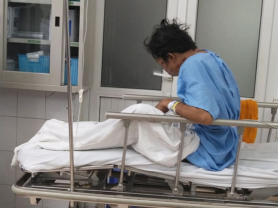 Bác sĩ ám ảnh vì những ca tai nạn giao thông do rượu hình ảnh 2 bac si am anh vi nhung ca tai nan giao thong do ruou hinh anh 2