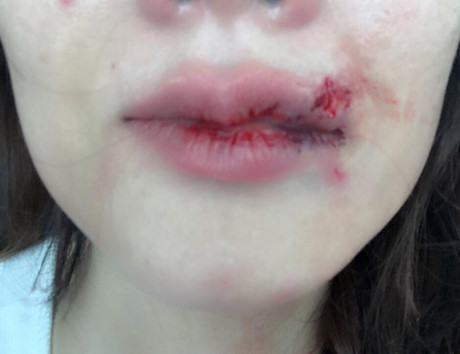 Chong dam toi chay mau rang vi... mot chiec quan lot moi - Anh 2