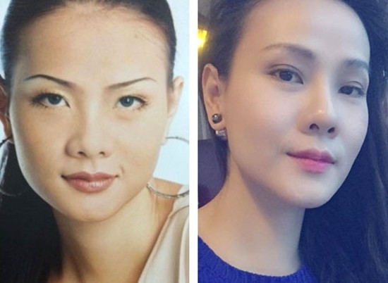 Trong một cuộc phỏng vấn thực hiện sau này, Dương Yến Ngọc mới tiết lộ năm 2006 cô từng trải qua một ca phẫu thuật nâng mũi bằng sụn nhân tạo. Do được làm khá tự nhiên nên hầu như không có ai đặt ra nghi vấn dao kéo với cô. Hành trình thay đổi nhan sắc của Dương Yến Ngọc sau 15 năm