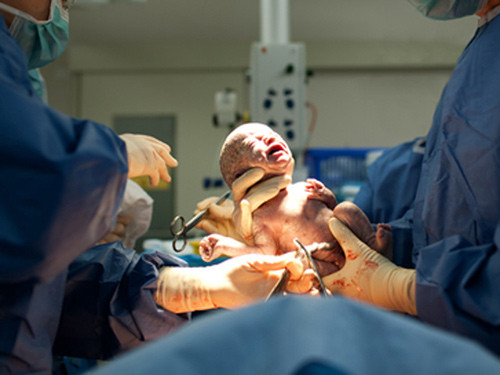 Lời khuyên "vàng" mẹ nào cũng cần biết trước khi đẻ mổ