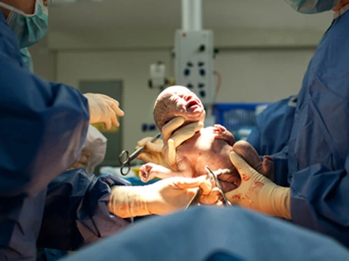 Lời khuyên "vàng" mẹ nào cũng cần biết trước khi đẻ mổ