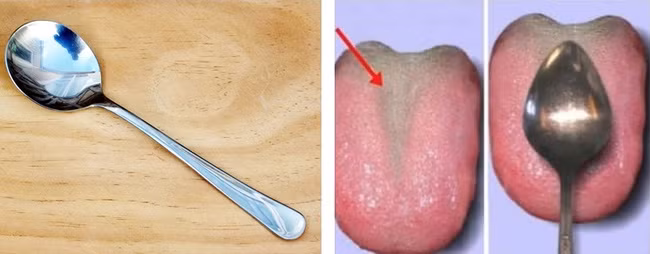 Đoán bệnh nội tạng chỉ với 1 chiếc thìa - Ảnh 2