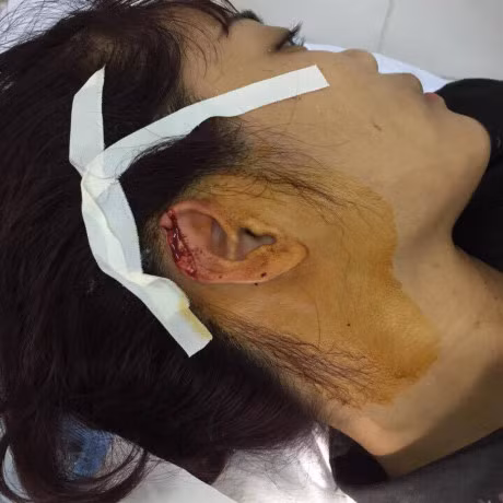 Giao vien day khieu vu the thao bi can dut tai - Anh 1