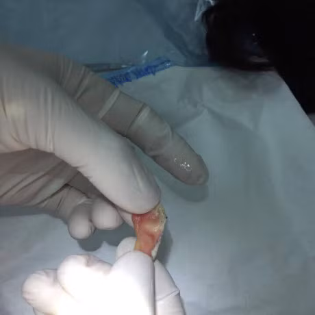 Giao vien day khieu vu the thao bi can dut tai - Anh 3