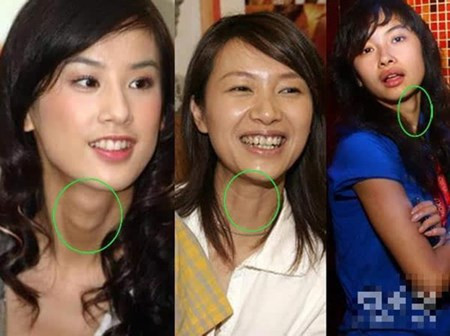 Mặt mụn, ngực lép, yết hầu thô của mỹ nhân Trung Quốc Mat mun, nguc lep, yet hau tho cua my nhan Trung Quoc