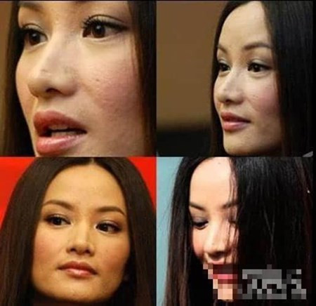 Mặt mụn, ngực lép, yết hầu thô của mỹ nhân Trung Quốc Mat mun, nguc lep, yet hau tho cua my nhan Trung Quoc