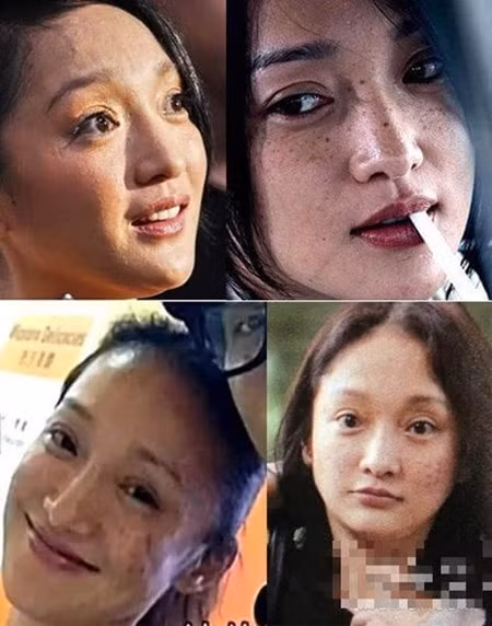 Mặt mụn, ngực lép, yết hầu thô của mỹ nhân Trung Quốc Mat mun, nguc lep, yet hau tho cua my nhan Trung Quoc