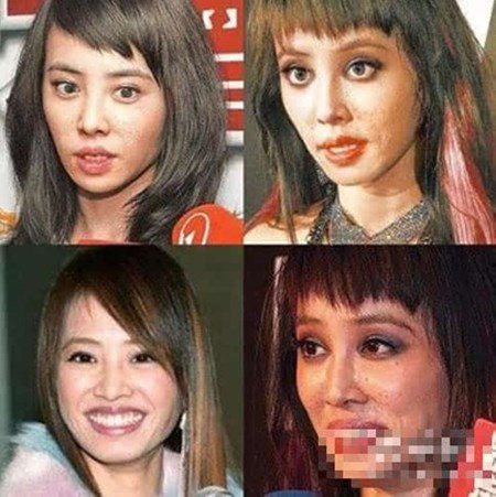 Mặt mụn, ngực lép, yết hầu thô của mỹ nhân Trung Quốc Mat mun, nguc lep, yet hau tho cua my nhan Trung Quoc