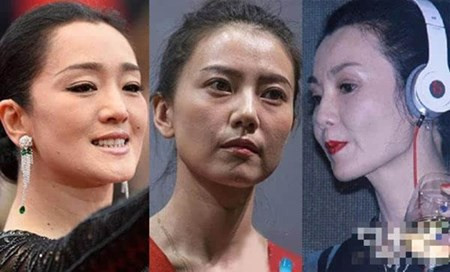 Mặt mụn, ngực lép, yết hầu thô của mỹ nhân Trung Quốc Mat mun, nguc lep, yet hau tho cua my nhan Trung Quoc