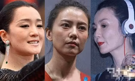 Mặt mụn, ngực lép, yết hầu thô của mỹ nhân Trung Quốc Mat mun, nguc lep, yet hau tho cua my nhan Trung Quoc