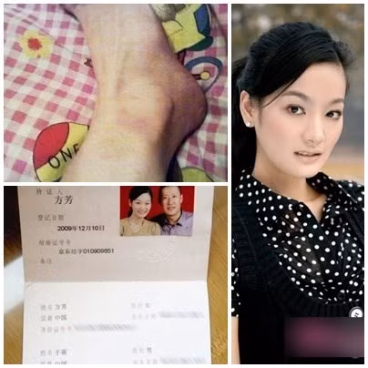 Phương Bá Nghê tung bằng chứng bị chồng bạo hành.