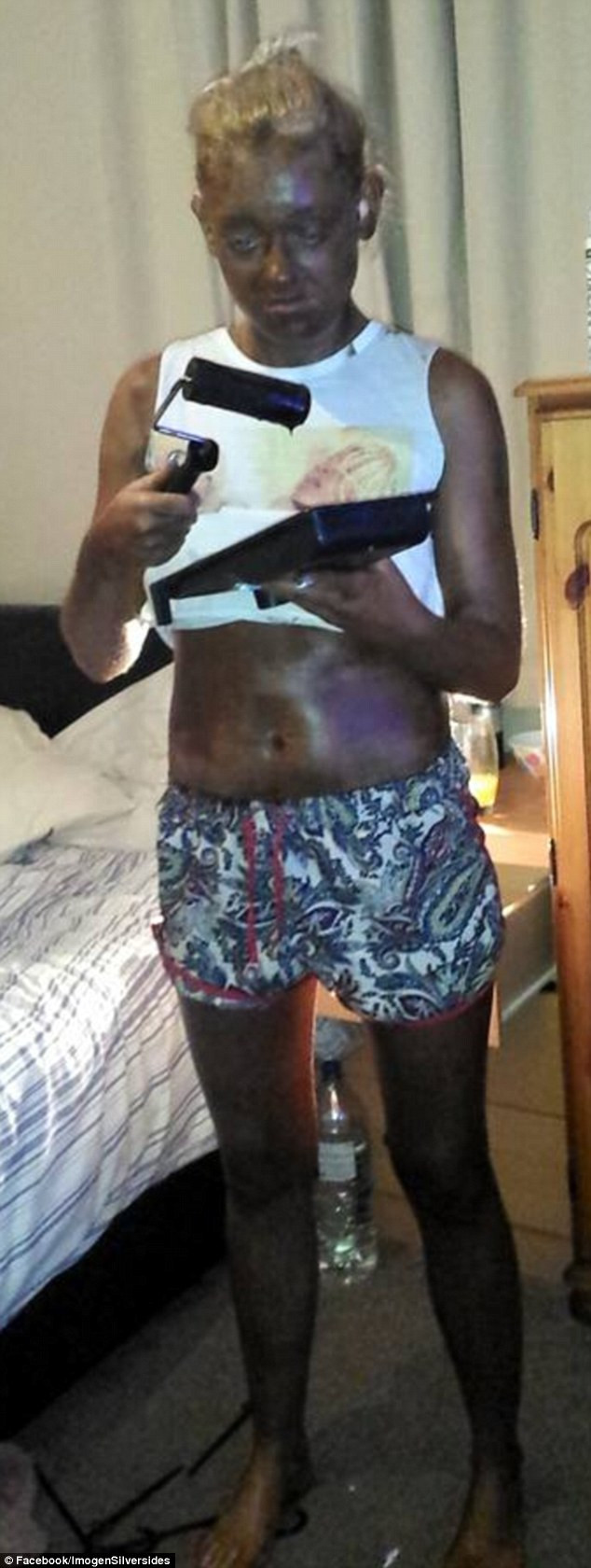 Cô gái nhận kết đắng sau khi nhuộm da bằng lăn sơn - Ảnh 1