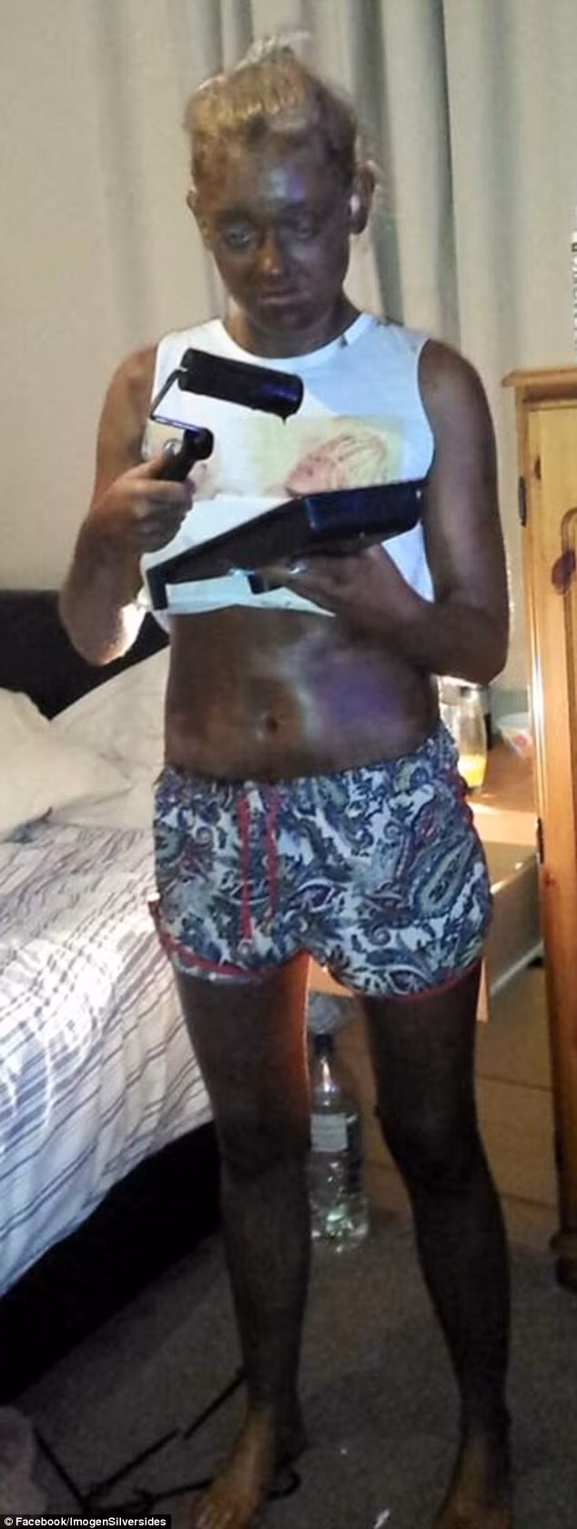 Cô gái nhận kết đắng sau khi nhuộm da bằng lăn sơn - Ảnh 1