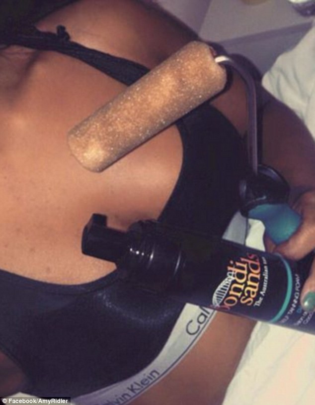 Cô gái nhận kết đắng sau khi nhuộm da bằng lăn sơn - Ảnh 4