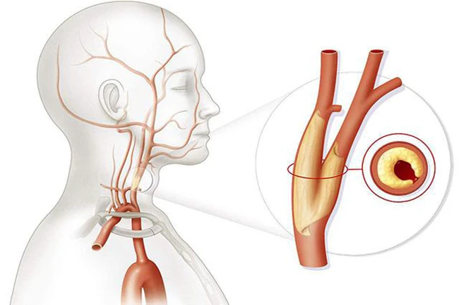 Không ngờ 10 loại thực phẩm phổ biến này có công dụng loại bỏ tạp chất trong máu