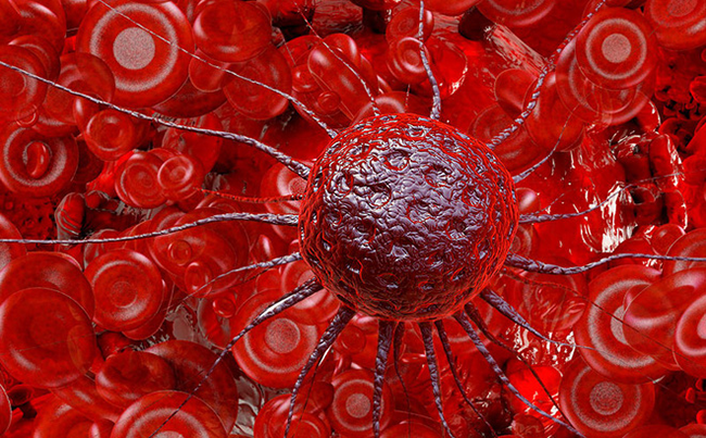 Có 1 trong 12 triệu chứng báo trước ung thư này, hãy đi khám ngay trước khi quá muộn! ảnh 2