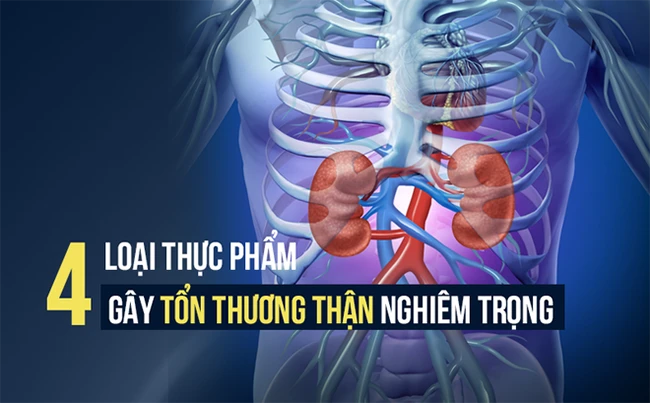 4 “kẻ thù” lặng lẽ phá hủy thận nặng nề, hãy ghi nhớ để tránh xa