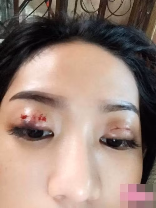 Midu-Phan Thành tái hợp, Thúy Vi tiếc nuối đi phẫu thuật thẩm mỹ?