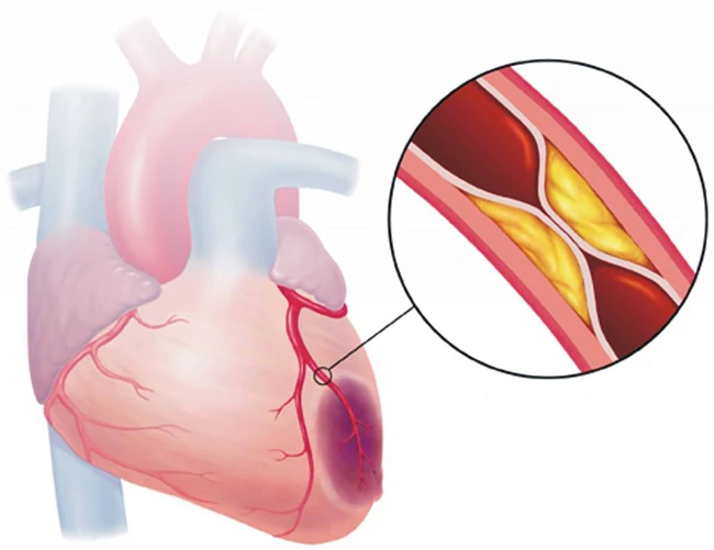 Một huyệt cứu tinh nằm ở chân, xoa bóp hàng ngày sẽ giúp tăng cường tuần hoàn máu