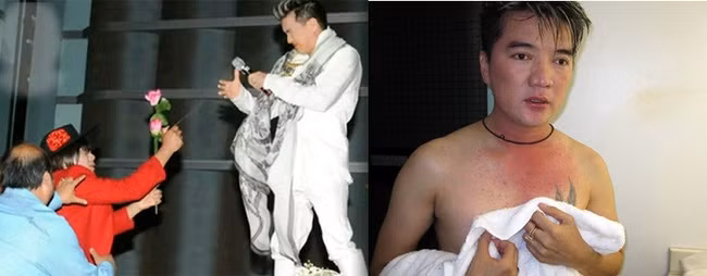 Diễn quá sung, Đàm Vĩnh Hưng gặp tai nạn chảy máu mắt - Ảnh 8.