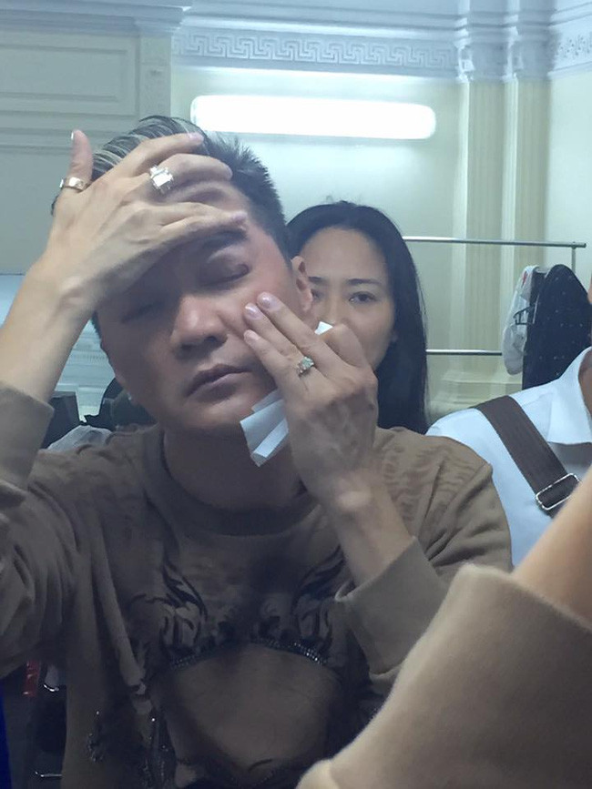 Diễn quá sung, Đàm Vĩnh Hưng gặp tai nạn chảy máu mắt - Ảnh 4. Diễn quá sung, Đàm Vĩnh Hưng gặp tai nạn chảy máu mắt - Ảnh 4.