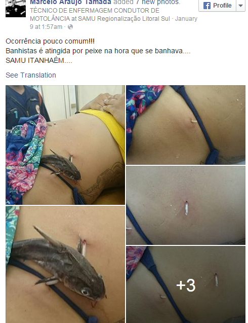 Người phụ nữ đau đớn vì bị cá 