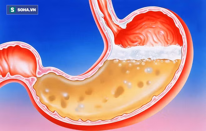 6 dấu hiệu không ngờ báo bạn đi khám bệnh tiêu hóa: Đừng để phải hối hận vì thành ung thư - Ảnh 1.