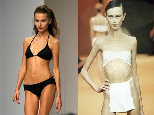 Góc khuất sàn diễn: Chết thảm vì giảm cân, tủi nhục bị xâm hại tình dục ảnh 1