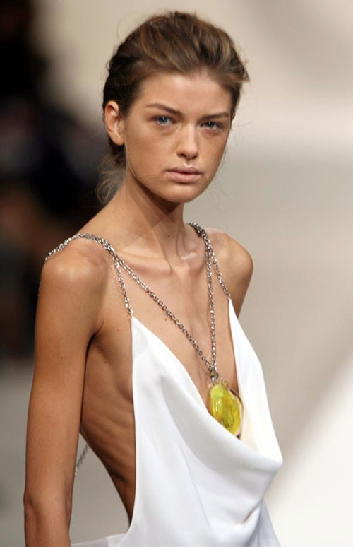 Góc khuất sàn diễn: Chết thảm vì giảm cân, tủi nhục bị xâm hại tình dục ảnh 2