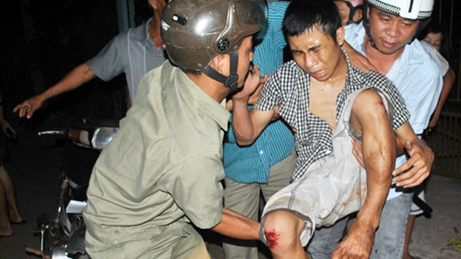 Ngã gãy chân, tên trộm van xin bị hại chở đi cấp cứu