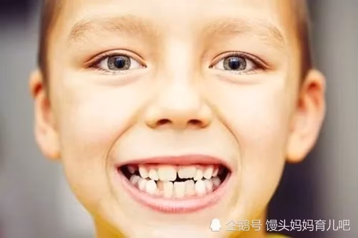 4 mẹo "dễ ợt" giúp bé "cai" ngay tật mút tay ảnh 3