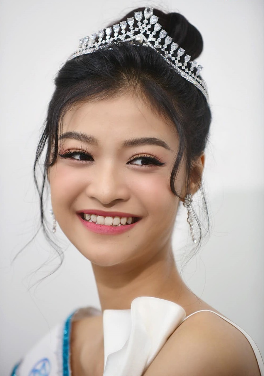 Khi vừa xuất sắc đạt ngôi vị Á hậu 1 Miss World Vietnam 2019, Kiều Loan được nhiều người nhớ tới khi sở hữu nụ cười tươi, chiếc răng khểnh duyên dáng nhưng sống mũi có phần hơi thấp, khiến tổng thể khuôn mặt chưa hài hòa. Khi vừa xuất sắc đạt ngôi vị Á hậu 1 Miss World Vietnam 2019, Kiều Loan được nhiều người nhớ tới khi sở hữu nụ cười tươi, chiếc răng khểnh duyên dáng nhưng sống mũi có phần hơi thấp, khiến tổng thể khuôn mặt chưa hài hòa.