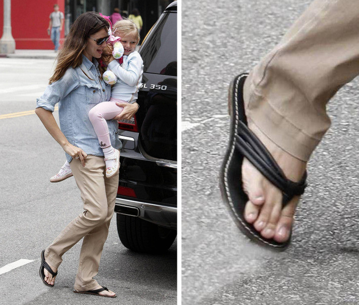 Jennifer Garner: Cô có ngón chân út cong vẹo và chồng lên nhau. Nhưng dù thế nào đi nữa, cô ấy vẫn thường xuyên đi giày hở mũi, dép xỏ ngón và vô cùng thoải mái với ngón chân đặc biệt của mình. Jennifer Garner: Cô có ngón chân út cong vẹo và chồng lên nhau. Nhưng dù thế nào đi nữa, cô ấy vẫn thường xuyên đi giày hở mũi, dép xỏ ngón và vô cùng thoải mái với ngón chân đặc biệt của mình.