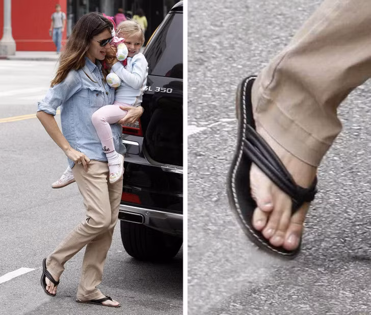Jennifer Garner: Cô có ngón chân út cong vẹo và chồng lên nhau. Nhưng dù thế nào đi nữa, cô ấy vẫn thường xuyên đi giày hở mũi, dép xỏ ngón và vô cùng thoải mái với ngón chân đặc biệt của mình.