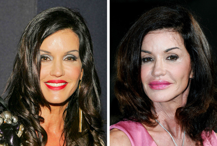 Siêu mẫu Janice Dickinson.