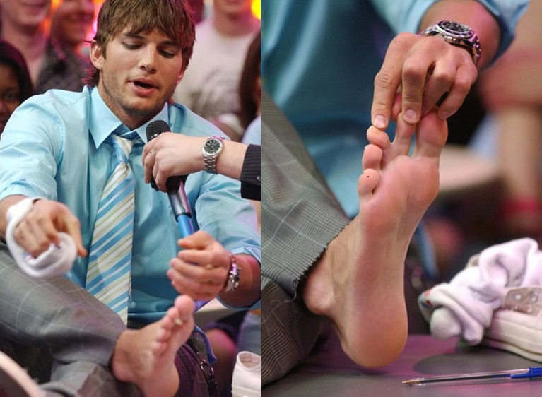 Ashton Kutcher: Bàn chân có màng của anh là do di truyền. Anh ấy đã từng khoe đôi chân của mình với một phóng viên và nó đã trở thành một câu chuyện thời sự lớn. Theo đó, hai ngón giữa trên bàn chân trái của anh bị dính liền nhau bởi một lớp màng giống như chân vịt. Anh cũng không ngại khoe dị tật kỳ lạ của mình với đông đảo người hâm mộ. Ashton Kutcher: Bàn chân có màng của anh là do di truyền. Anh ấy đã từng khoe đôi chân của mình với một phóng viên và nó đã trở thành một câu chuyện thời sự lớn. Theo đó, hai ngón giữa trên bàn chân trái của anh bị dính liền nhau bởi một lớp màng giống như chân vịt. Anh cũng không ngại khoe dị tật kỳ lạ của mình với đông đảo người hâm mộ.