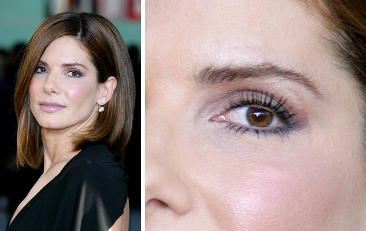 Sandra Bullock: Nữ diễn viên có một vết sẹo nhỏ gần mắt trái do khi còn là một thiếu niên cô đã bị trượt chân ngã xuống hồ và đập đầu vào một tảng đá. Sau đó, vết cắt nhỏ đã để lại sẹo trên đuôi mắt. Sandra Bullock: Nữ diễn viên có một vết sẹo nhỏ gần mắt trái do khi còn là một thiếu niên cô đã bị trượt chân ngã xuống hồ và đập đầu vào một tảng đá. Sau đó, vết cắt nhỏ đã để lại sẹo trên đuôi mắt.