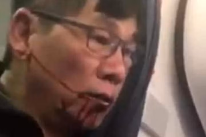 Hình ảnh bác sĩ David Dao, mặt đầy máu sau khi bị hãng hàng không United Airlines dùng vũ lực ép rời khỏi chuyến bay đang gây bão dư luận