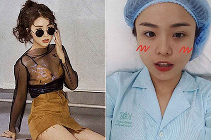 Quỳnh Anh Shyn gợi cảm sau scandal, Thái Trinh công khai dao kéo